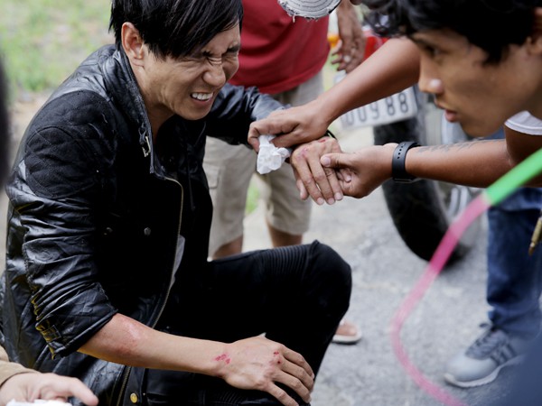 Sao Việt và những lần gặp tai nạn nghiêm trọng: Gãy xương, suy giảm thị lực nhưng vẫn chưa phải điều kinh khủng nhất-6