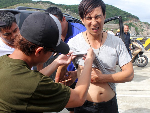 Sao Việt và những lần gặp tai nạn nghiêm trọng: Gãy xương, suy giảm thị lực nhưng vẫn chưa phải điều kinh khủng nhất-7