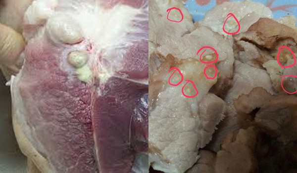 Đâu chỉ do ăn phải thịt lợn gạo, những kiểu ăn uống này cũng dễ khiến bạn bị cả búi sán làm tổ trong người!-6