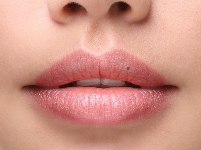 4 vị trí nốt ruồi được ví như ‘bùa yêu’, ai sở hữu dù không xinh đẹp vẫn trăm người theo đuổi, cực giàu-3