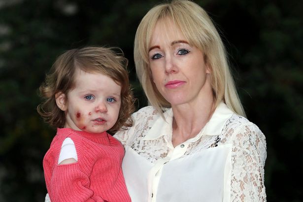 Vừa rời mắt 1 giây, mẹ quay lại đã thấy con bị cắn 15 vết sâu hoắm khắp người, thủ phạm đứng nhìn với nụ cười đầy máu-1