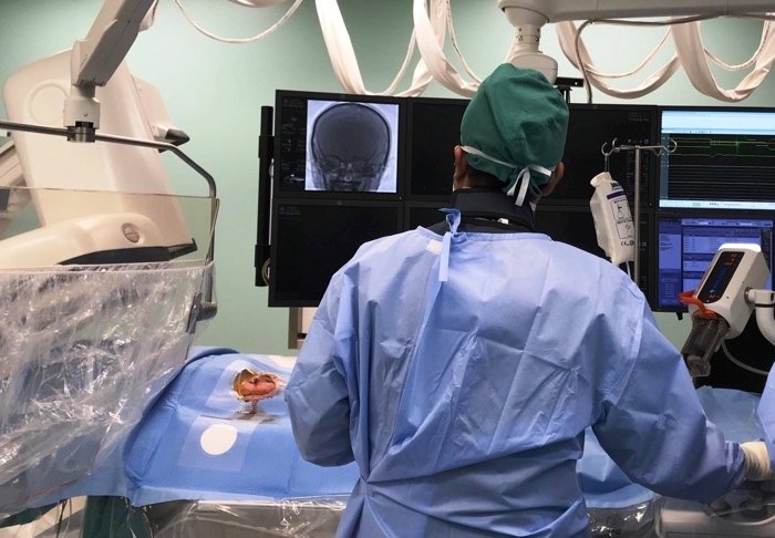 Bé trai 5 tuổi bị đột quỵ-1