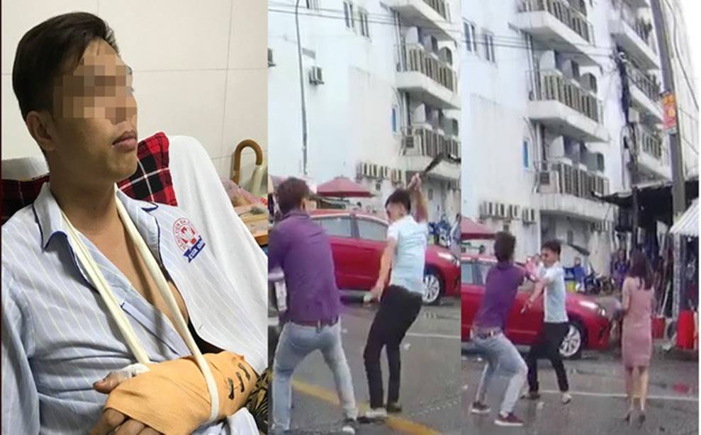 Vụ chặt tay tài xế ô tô: Nạn nhân bị đứt động mạch, máu phun không ngừng khi vào bệnh viện-1
