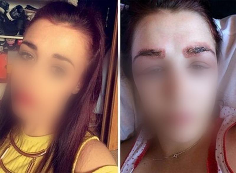 Tốn bộn tiền đi làm chân mày, kết quả khiến chị em xấu hổ tới mức... chẳng dám ra đường-11