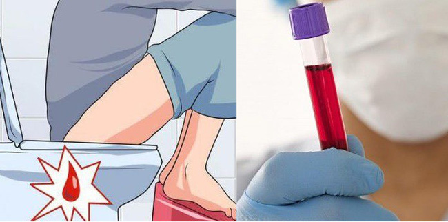 U nang buồng trứng đang tìm đến bạn nếu bạn có những dấu hiệu này-5