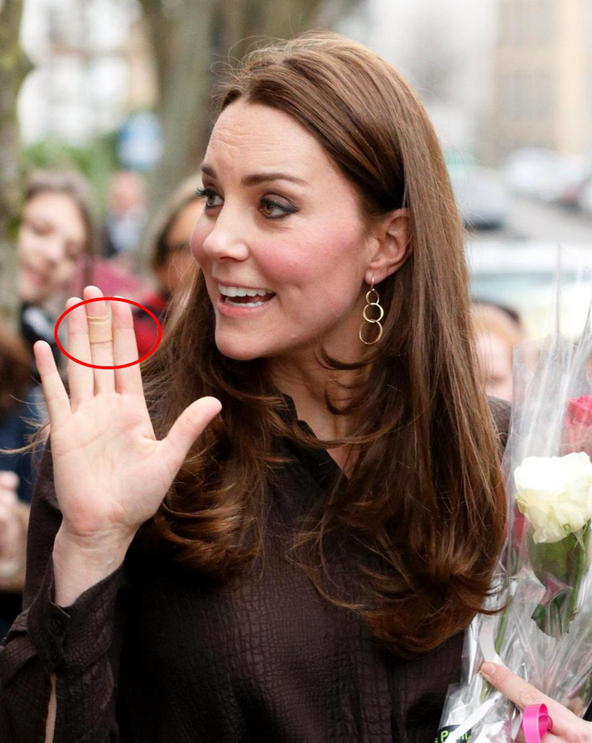 Công nương Kate là nàng dâu hậu đậu nhất” hoàng gia bởi một loạt vết tích trên tay không giống ai của mình-7