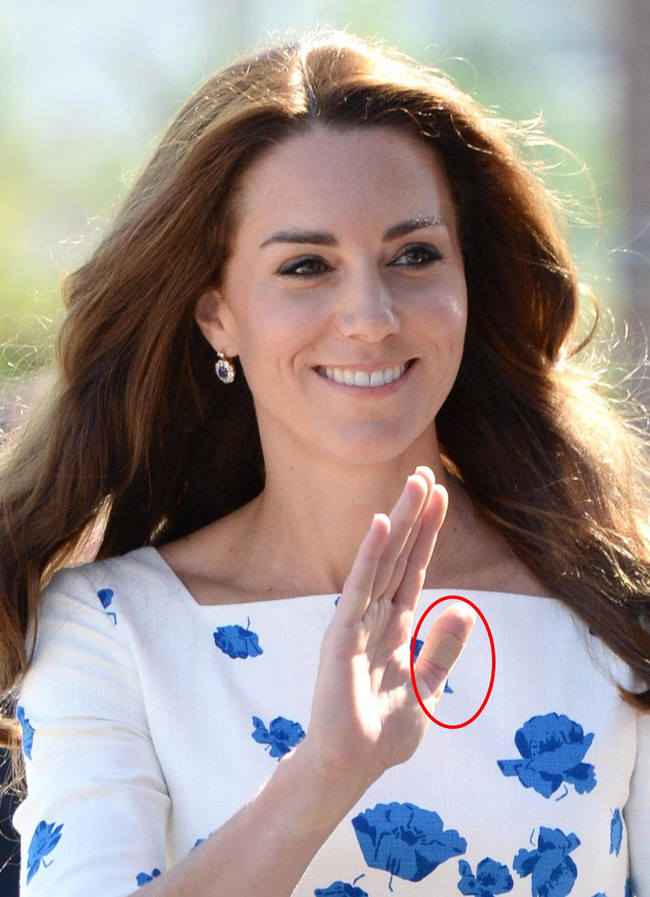 Công nương Kate là nàng dâu hậu đậu nhất” hoàng gia bởi một loạt vết tích trên tay không giống ai của mình-5