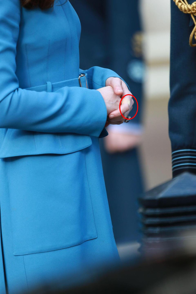Công nương Kate là nàng dâu hậu đậu nhất” hoàng gia bởi một loạt vết tích trên tay không giống ai của mình-9