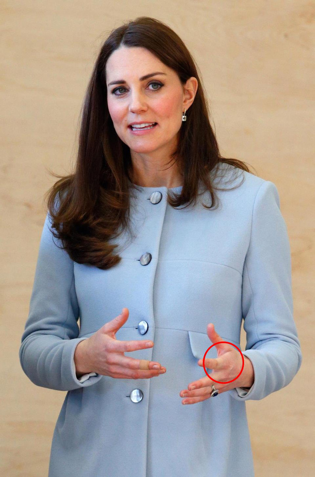 Công nương Kate là nàng dâu hậu đậu nhất” hoàng gia bởi một loạt vết tích trên tay không giống ai của mình-8