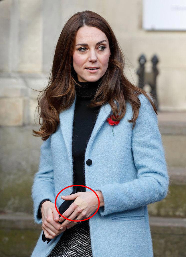 Công nương Kate là nàng dâu hậu đậu nhất” hoàng gia bởi một loạt vết tích trên tay không giống ai của mình-4