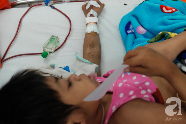 Bác sĩ cảnh báo: Bao bì thực phẩm chứa hóa chất này là tác nhân khiến hàng ngàn trẻ bị bệnh thận-1