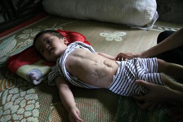 Bác sĩ trả về lo hậu sự, bố mẹ thà bán nhà quyết không ngừng cứu sống con trai-2