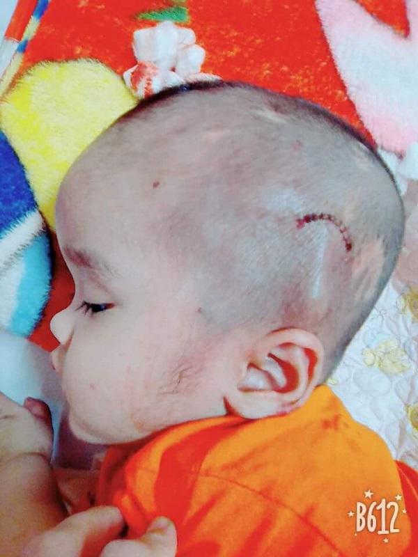 Bác sĩ trả về lo hậu sự, bố mẹ thà bán nhà quyết không ngừng cứu sống con trai-3