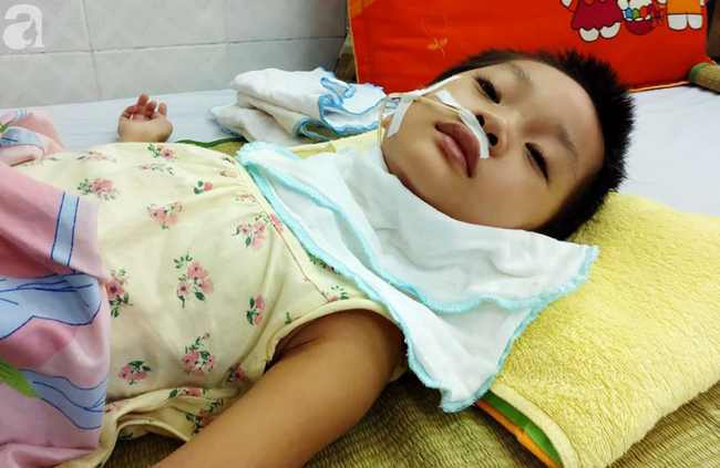 Bé gái 5 tuổi bị viêm màng não tự miễn sau cơn co giật, hơn 1 tháng không thể ngủ và liên tục la hét-2