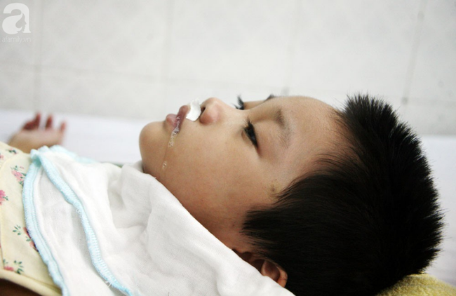 Bé gái 5 tuổi bị viêm màng não tự miễn sau cơn co giật, hơn 1 tháng không thể ngủ và liên tục la hét-4