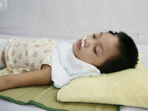 Bé gái 5 tuổi bị viêm màng não tự miễn sau cơn co giật, hơn 1 tháng không thể ngủ và liên tục la hét