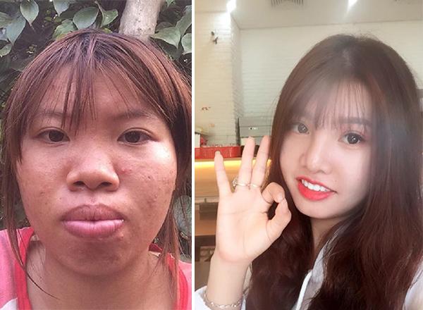 Bị chê xuống sắc hậu dao kéo, Phượng Thị Nở khoe ảnh nhan sắc thay đổi chóng mặt-1