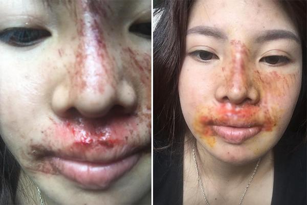 Bị chê xuống sắc hậu dao kéo, Phượng Thị Nở khoe ảnh nhan sắc thay đổi chóng mặt-4