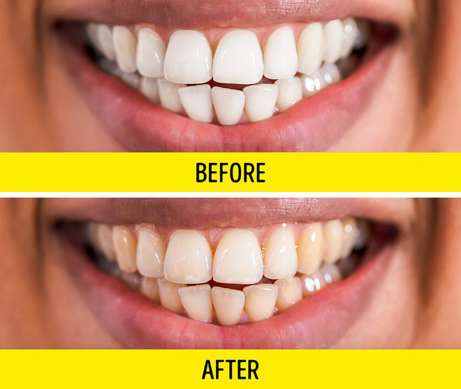 8 tác dụng phụ của kháng sinh mà ngay cả bác sĩ cũng không thường xuyên nói cho bạn biết-2