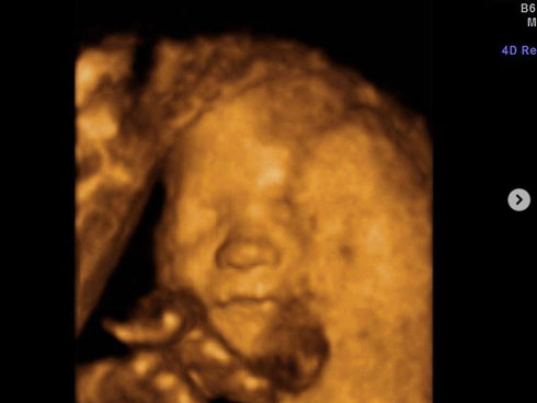 Mẹ vào bếp nấu cơm, nửa tiếng sau quay lại thấy cảnh tượng ám ảnh suốt đời và bi kịch ập đến với cô con gái nhỏ-3