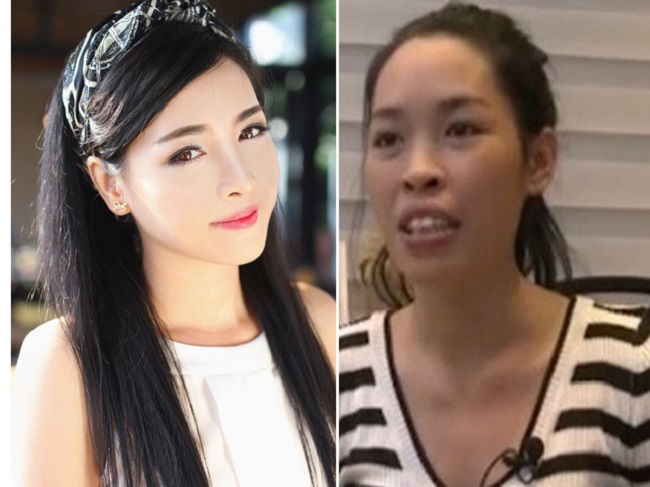 8 ca thẩm mỹ của chị em Việt gây bão dư luận vì biến gái xấu thành tiên-5