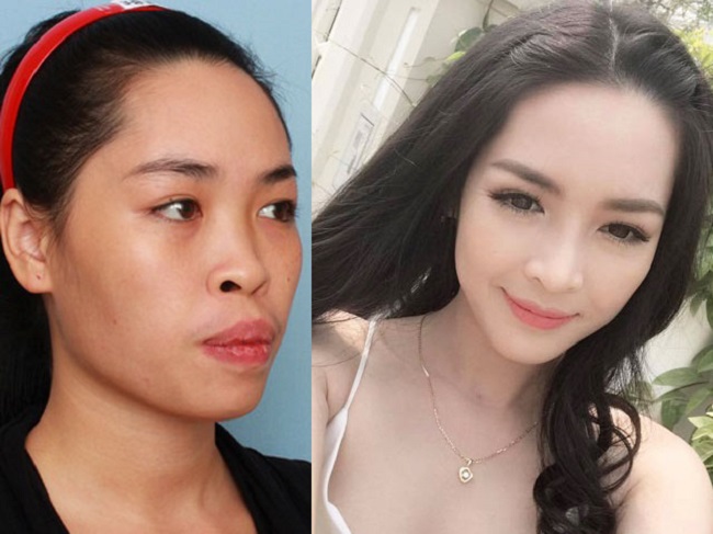 8 ca thẩm mỹ của chị em Việt gây bão dư luận vì biến gái xấu thành tiên-6