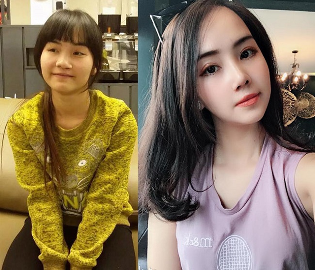 8 ca thẩm mỹ của chị em Việt gây bão dư luận vì biến gái xấu thành tiên-7
