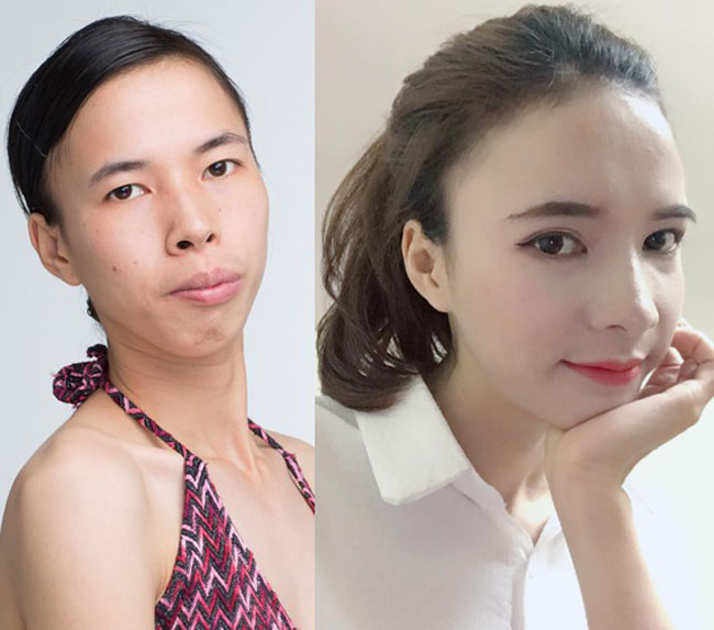 8 ca thẩm mỹ của chị em Việt gây bão dư luận vì biến gái xấu thành tiên-14