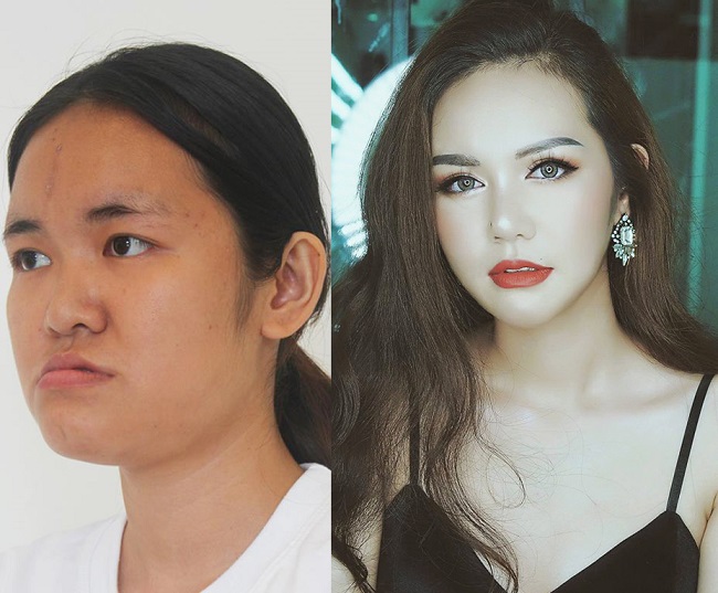 8 ca thẩm mỹ của chị em Việt gây bão dư luận vì biến gái xấu thành tiên-9