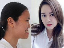 8 ca thẩm mỹ của chị em Việt gây bão dư luận vì biến 'gái xấu thành tiên' 8 ca thẩm mỹ của chị em Việt gây bão dư luận vì biến 'gái xấu thành tiên'