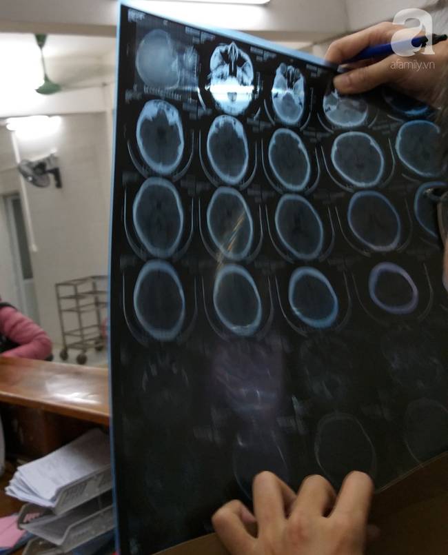 Nữ sinh lớp 9 tố bị vợ hai của bố đập đầu, đánh tới mức phải nhập viện-3