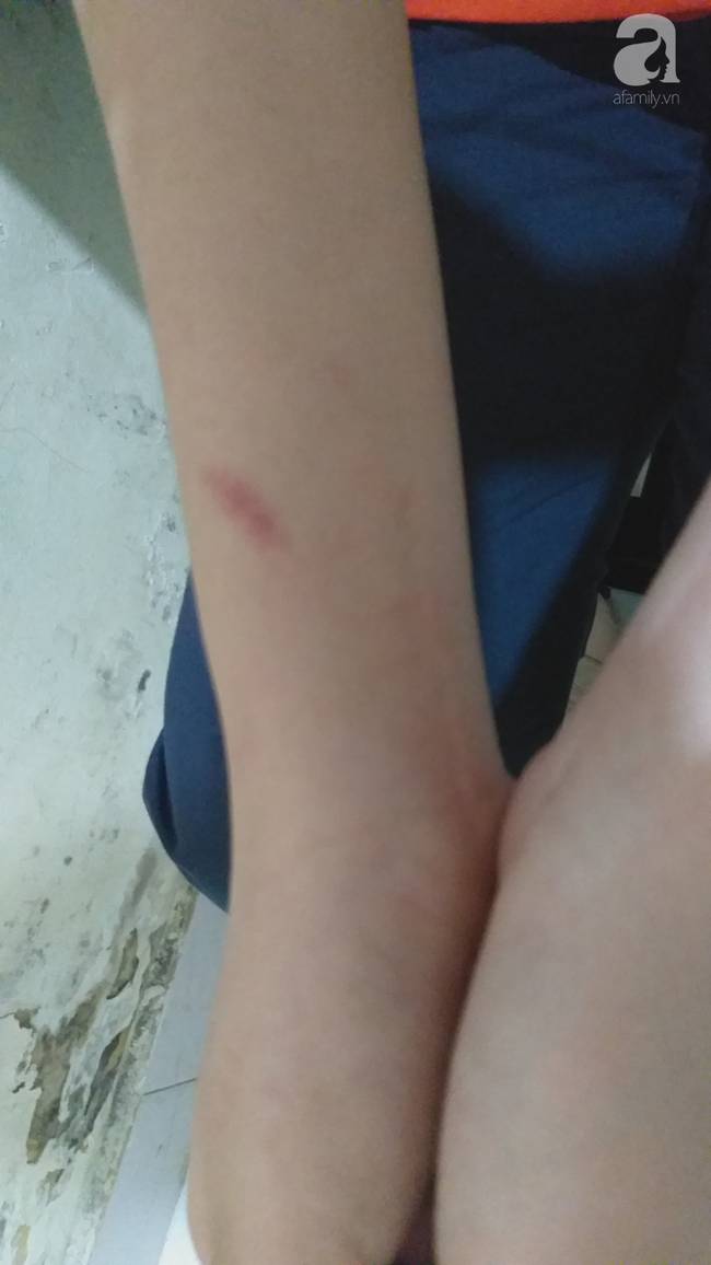 Nữ sinh lớp 9 tố bị vợ hai của bố đập đầu, đánh tới mức phải nhập viện-7