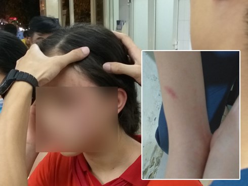 Nữ sinh lớp 9 tố bị vợ hai của bố đập đầu, đánh tới mức phải nhập viện