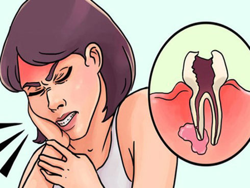 Mua răng... trên mạng, trào lưu làm đẹp nguy hiểm của giới trẻ-4