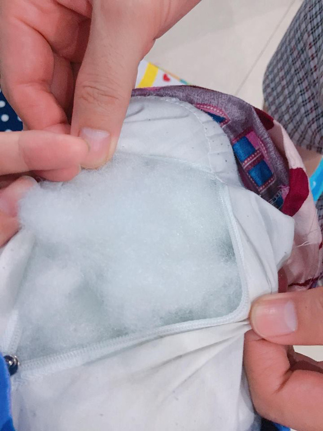 Con chảy mủ hôi tanh cả tháng không khỏi, mẹ phát hoảng khi gắp được dị vật thân quen trong mũi của con-3