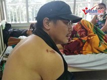 Đạo diễn trường Sân khấu: Lái xe ôm hút cần sa, tôi ngồi sau nên dương tính Đạo diễn trường Sân khấu: Lái xe ôm hút cần sa, tôi ngồi sau nên dương tính