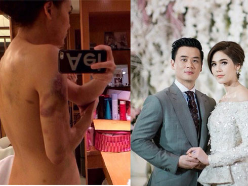 Con dâu ghê gớm một mực đòi ly hôn, mẹ chồng ủ mưu thả 2 viên thuốc vào cốc nước-3