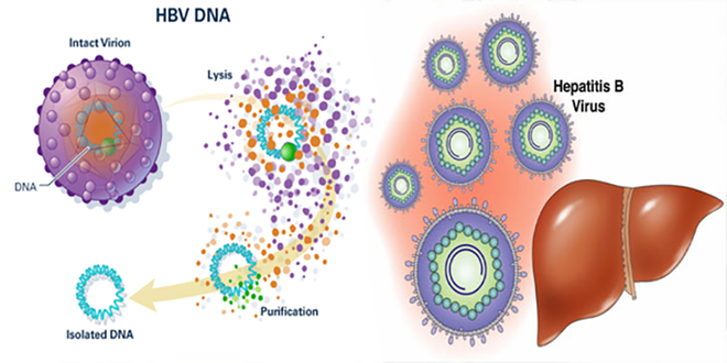 4 yếu tố không ngờ có thể gây viêm gan B: Hầu hết mọi người đều có thể mắc mà không biết-2