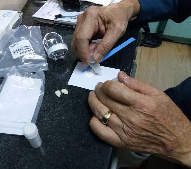 Mua răng... trên mạng, trào lưu làm đẹp nguy hiểm của giới trẻ-2