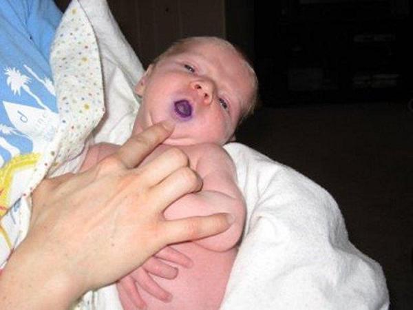 Hốt hoảng khi tay chân con tím ngắt, nhìn vào bữa ăn mẹ chuẩn bị liền hiểu lý do-1