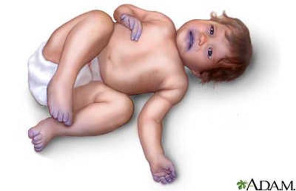 Hốt hoảng khi tay chân con tím ngắt, nhìn vào bữa ăn mẹ chuẩn bị liền hiểu lý do-2