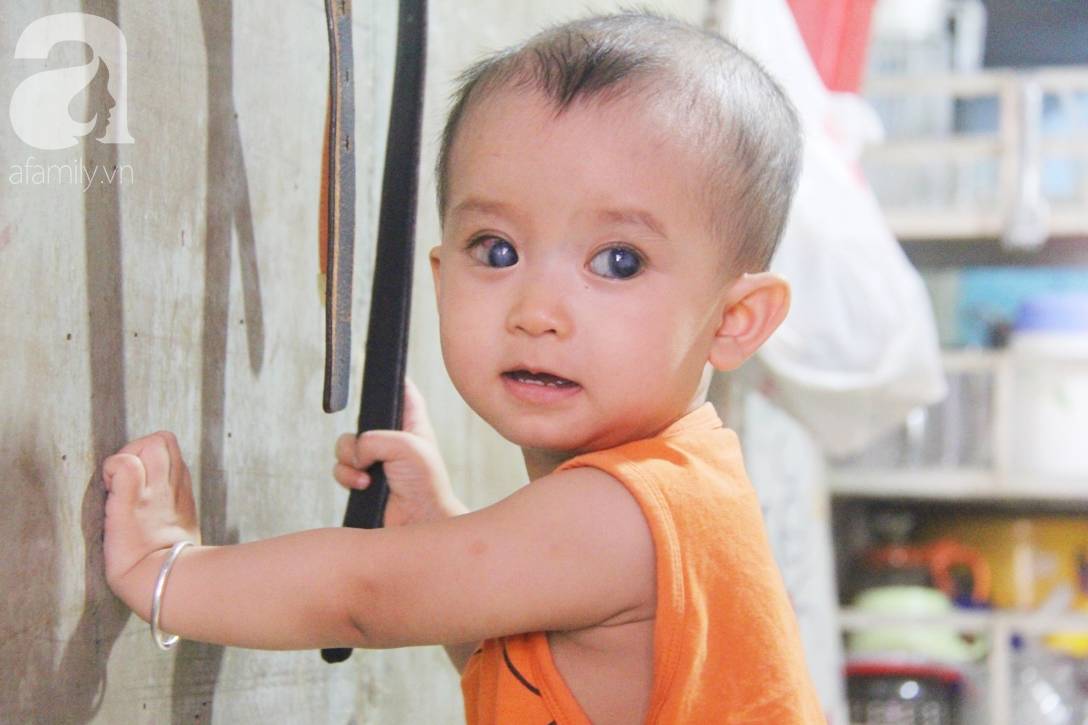 Em quỳ gối xin mọi người hãy cứu lấy Gia Anh, không được ghép giác mạc con em sẽ mù vĩnh viễn-2