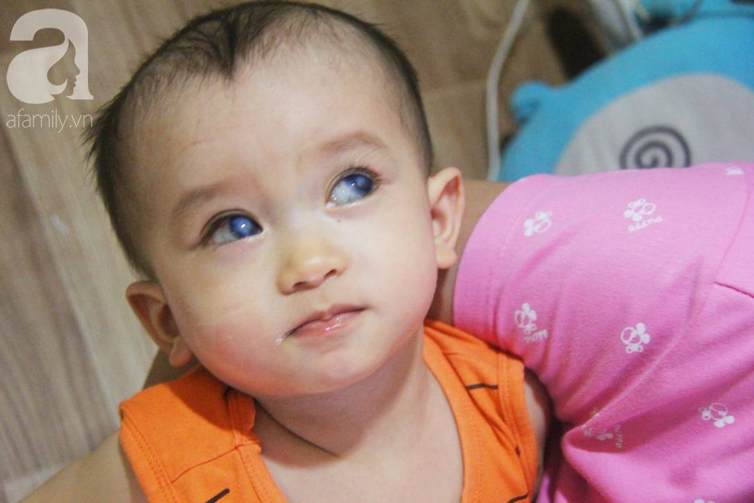 Em quỳ gối xin mọi người hãy cứu lấy Gia Anh, không được ghép giác mạc con em sẽ mù vĩnh viễn-9