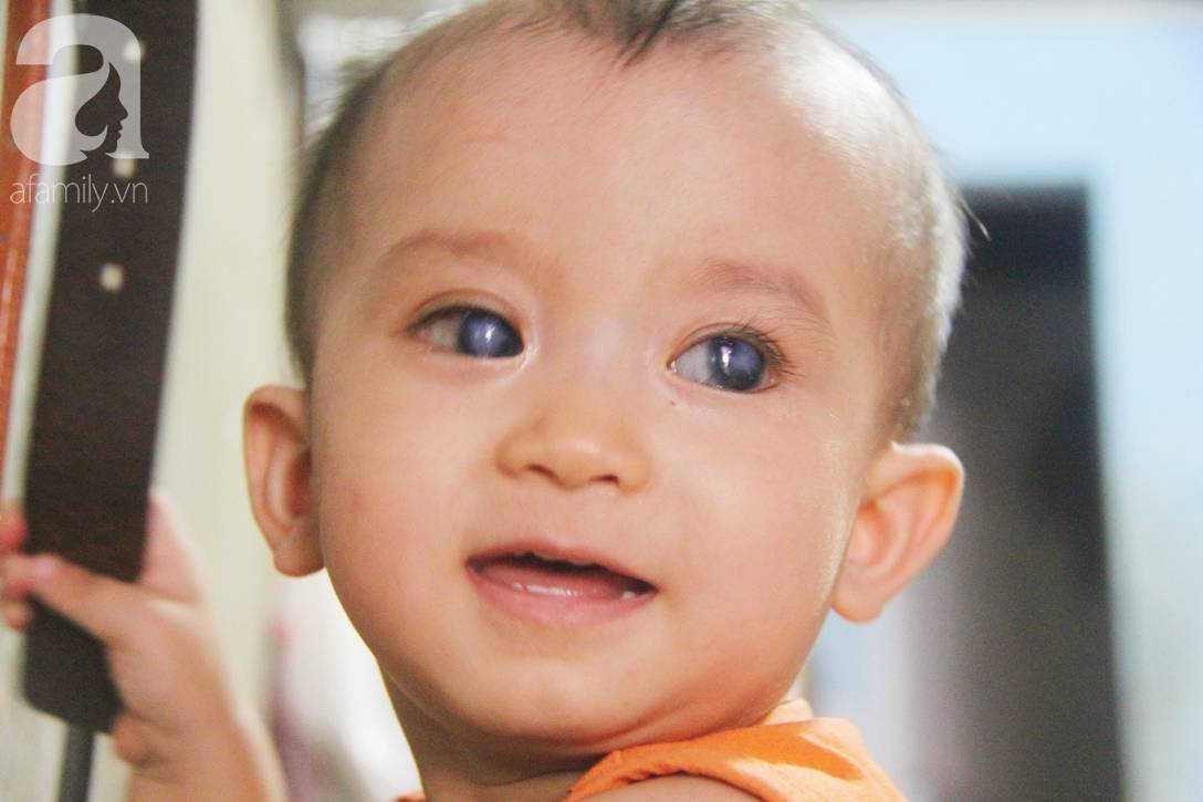 Em quỳ gối xin mọi người hãy cứu lấy Gia Anh, không được ghép giác mạc con em sẽ mù vĩnh viễn-14