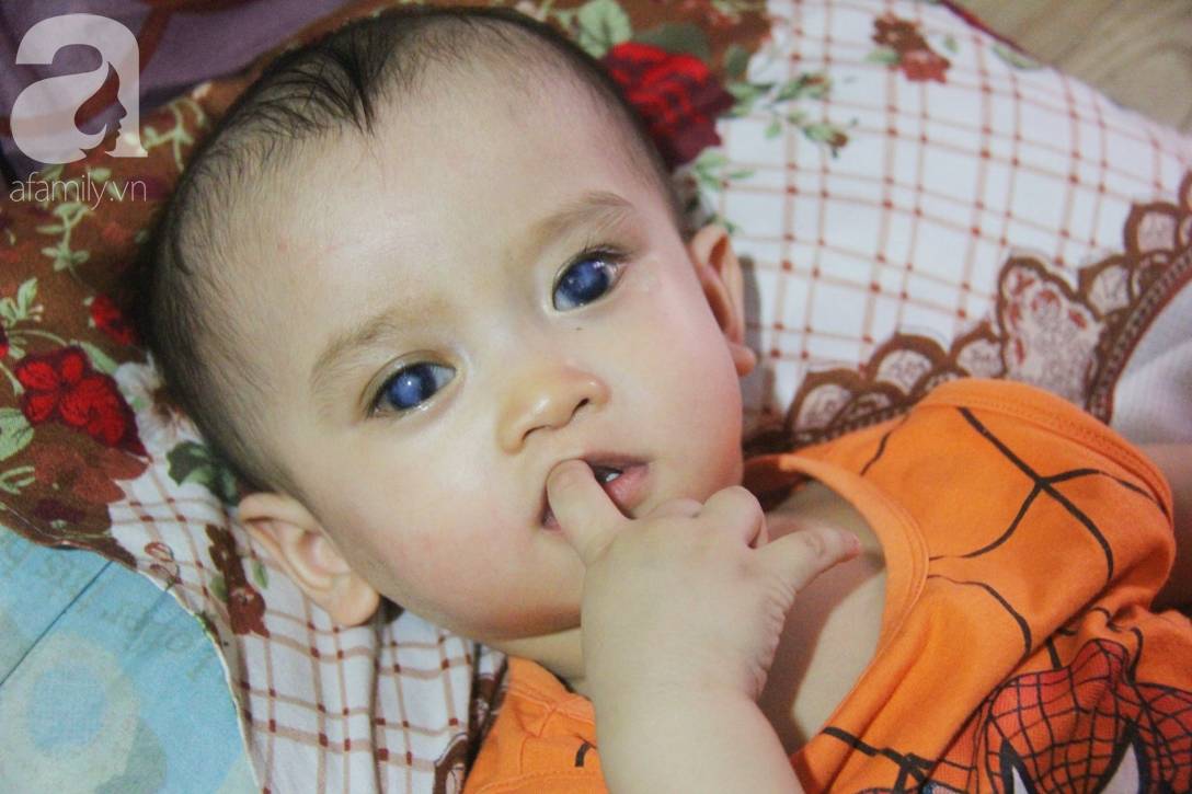 Em quỳ gối xin mọi người hãy cứu lấy Gia Anh, không được ghép giác mạc con em sẽ mù vĩnh viễn-15