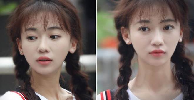 Nổi tiếng chưa lâu, Ngụy Anh Lạc bị tố độn cằm, lộ ảnh quá khứ khác xa hiện tại-1