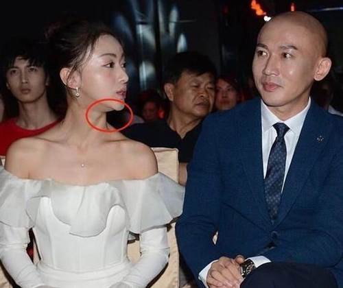 Nổi tiếng chưa lâu, Ngụy Anh Lạc bị tố độn cằm, lộ ảnh quá khứ khác xa hiện tại-7