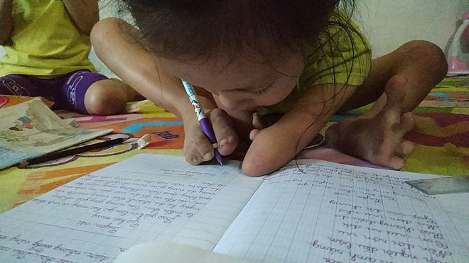 Nghị lực sống phi thường của cô bé chim cánh cụt-1