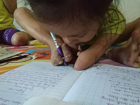 Nữ sinh lớp 10 bị ung thư máu: Em không cho phép mình gục ngã-5