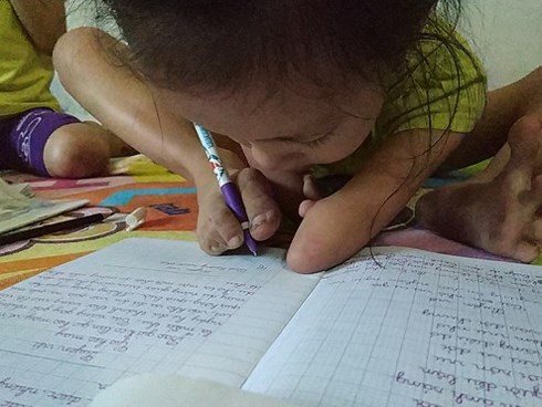 Nghị lực sống phi thường của cô bé 'chim cánh cụt'